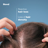 Ducray Anaphase+ Anti-Hair Loss Complement Shampoo 200Ml