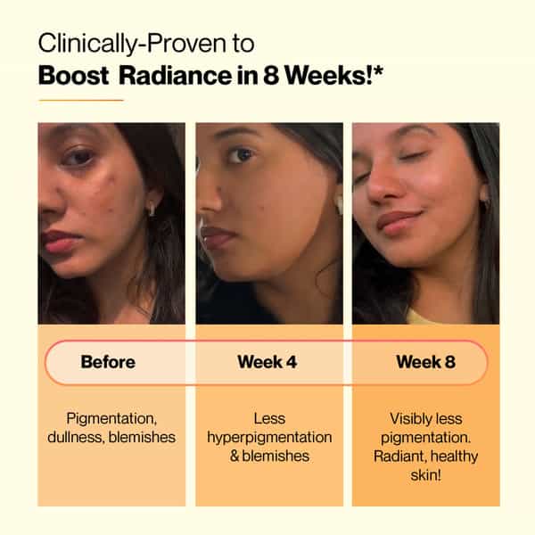 glutathione tablets for hyperpigmentation Buy SETU SKIN RENEW - 15 EFFERVESCENT | WITH VITAMIN C moisterizer Size:1 Tube IV Drip Therapy :