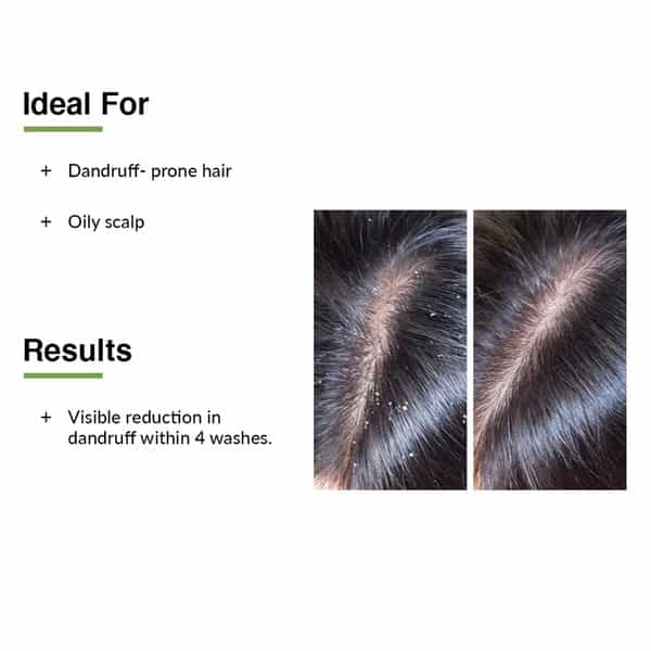 Fixderma Kairfoll Anti Dandruff Shampoo For Oily Sensitive Scalp | Sulphate Free Shampoo - 100 Ml