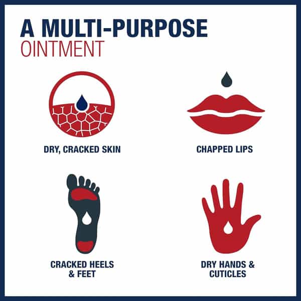 Aquaphor Healing Oinment | Dry | Cracked And Irritated Skin Protectant 7 Oz 198 Gm