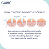 Gubb Derma Roller 0.5Mm For Hair Regrowth Face Acne Scars & Skin Aging 540 Micro Needles - Green