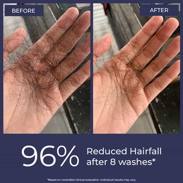 Conscious Chemist Anti Hairfall Shampoo | Saw Palmetto & Rosemary | Hard Water Safe | 200Ml