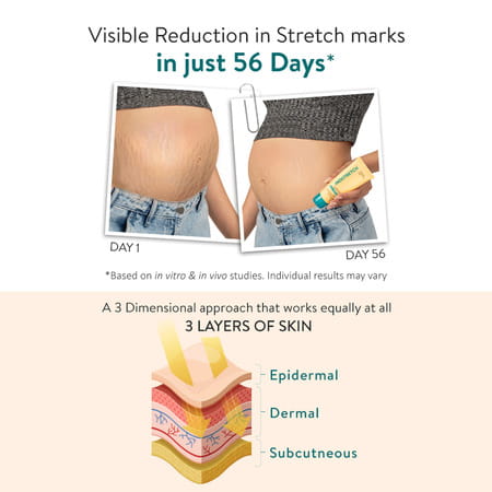 Inostretch Stretch Mark Cream | Reduce Stretch Marks & Scars - 60g (Pack Of 4)