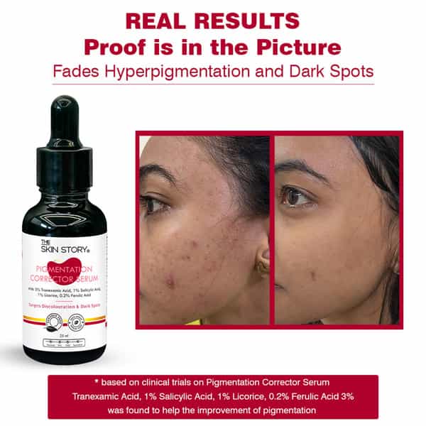 The Skin Story 2% Alpha Arbutin 2% Niacinamide Face Serum For Pigmentation Age Spots Dark Spots 25Ml