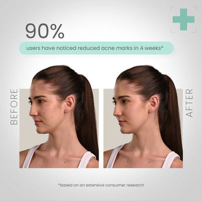 View product image 4