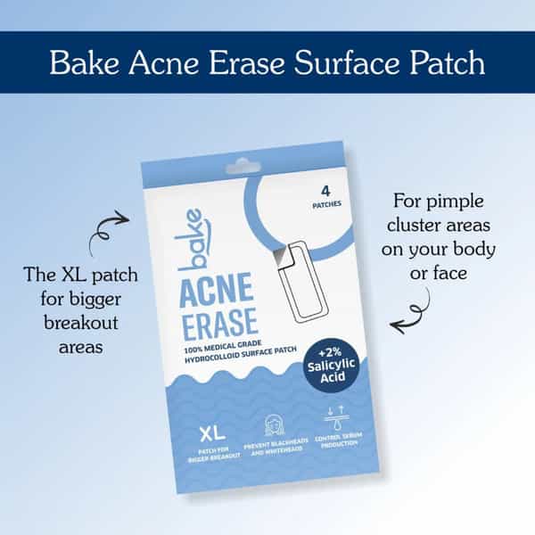 Bake 2% Salicylic Acid Hydrocolloid Acne Patches Xl For Pimples & Blackheads (4 Patches)