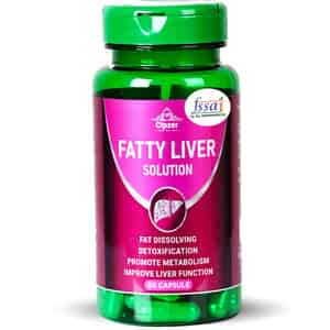Cipzer Fatty Liver Solution Capsule Manage Fatty Liver Conditions,supports Liver Health 60 Capsules