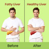 Cipzer Fatty Liver Solution Capsule Manage Fatty Liver Conditions,Supports Liver Health 60 Capsules