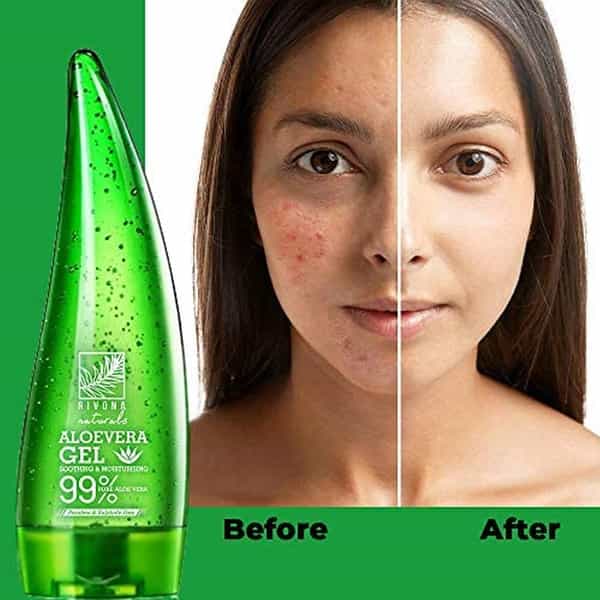 Rivona Naturals 99% Pure & Organic Aloe Vera Gel For Face | Skin And Hair - 125 Ml