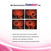 Iscanbreast - Breast Self-Examination Device - 1 Unit