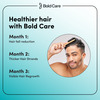 Bold Care Minoxidil Topical Solution Usp 5% Hair Serum For Men |Targets Hair Regrowth - 30Ml