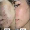 Sereko Pore Clearing Face Wash 100 Ml