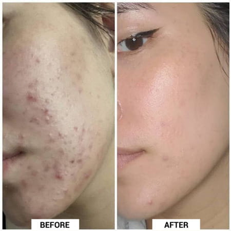 Sereko Pore Clearing Face Wash 100 Ml