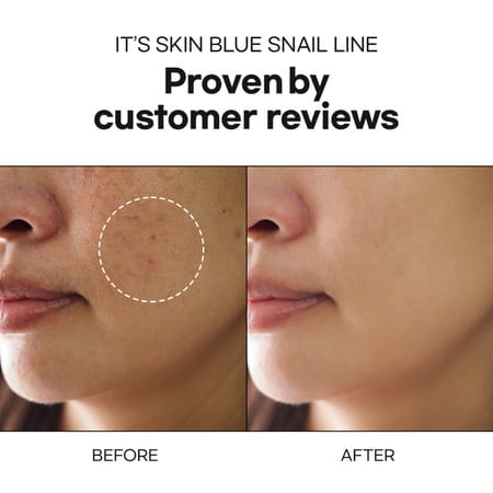 It'S Skin Blue Snail Serum - Day And Night Serum - Hydrating Face Serum - 40 Ml