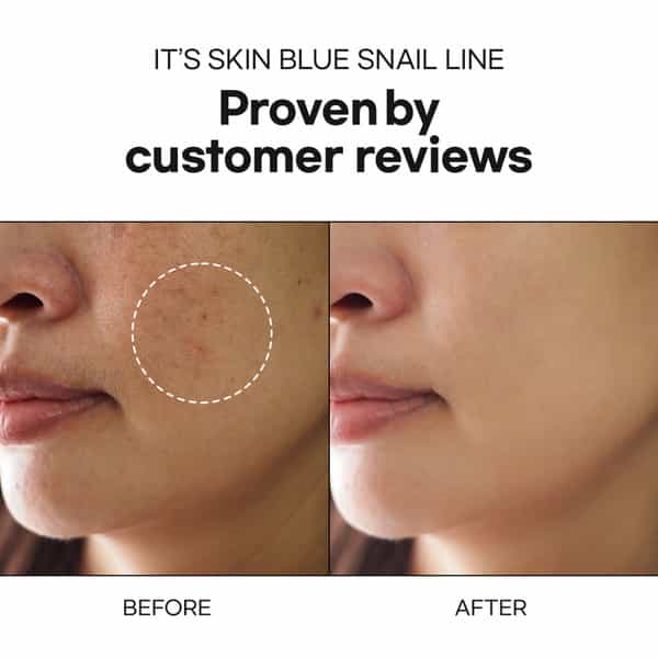 It's Skin Blue Snail Serum - Day And Night Serum - Hydrating Face Serum - 40 Ml