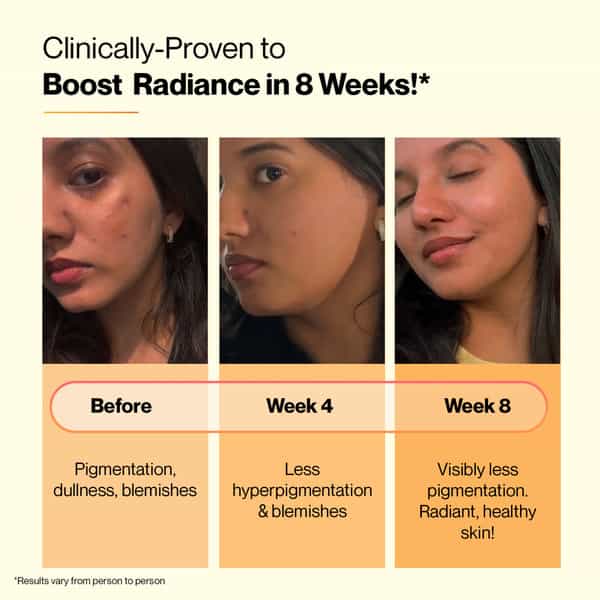 Setu Skin Renew - 30 Effervescent Tablets Mixed Berry & Orange Flavour | Glutathione With Vitamin C