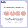 Gubb Usa Derma Roller 0.5Mm For Face Acne Scars Skin Ageing Titanium Micro Needles Red Color