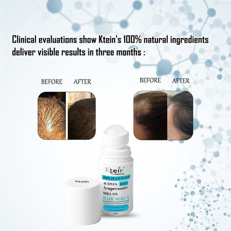 Ktein 100% Plant-Based Active Intensive Hair Treatment Serum With Acupressure Roll-On 20ml