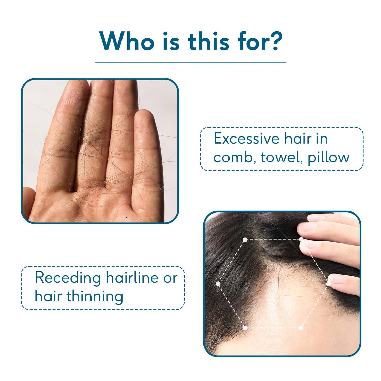 Headful Buy HEALTHKART HK VITALS HAIRFALL SOLUTION KIT STAGE 1 | HAIR ...