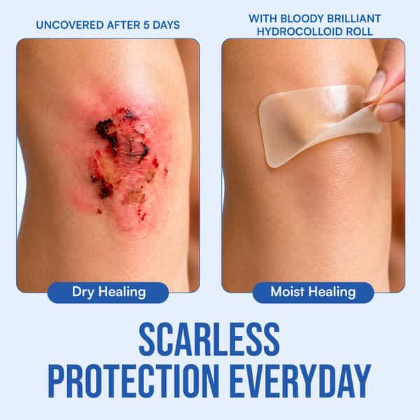 Bloody Brilliant Medical Grade Hydrocolloid Dressing | Waterproof | Cut-To-Fit | 5Cm X 200Cm(6.5Ft)