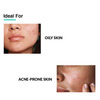 Fixderma Anti Acne Face Serum With Salicylic Acid - 15 G