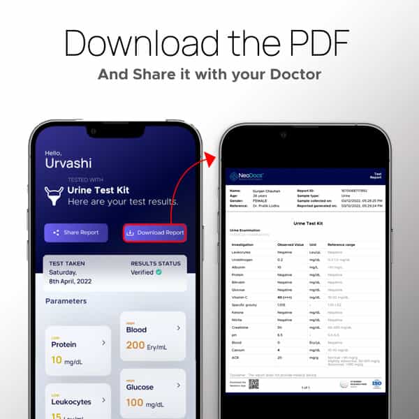 Neodocs Advanced Urine Test Kits | Track 15 Parameters
