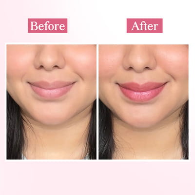 View product image 3