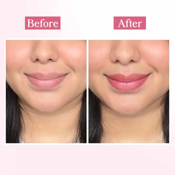 Tnw The Natural Wash Cc Lip Balm Strawberry | Brightening & Nourishing Lips 5 Gm