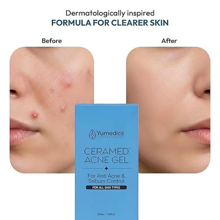 Yumedics Ceramed Acne Gel - 20Ml