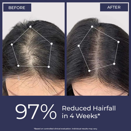 Conscious Chemist Rosemary Water Spray 200Ml | Hair Growth | Redensyl & Tripeptide - 1