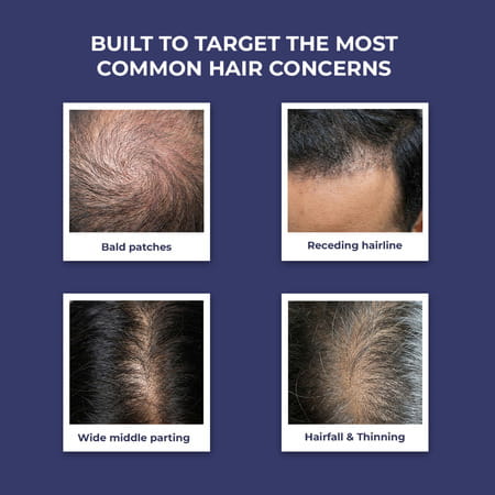 Conscious Chemist Rosemary Water Spray 200Ml | Hair Growth | Redensyl & Tripeptide - 1