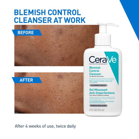 Cerave Blemish Control Cleanser With 2% Salicylic Acid & Niacinamide For Acne-Prone Skin 236ml