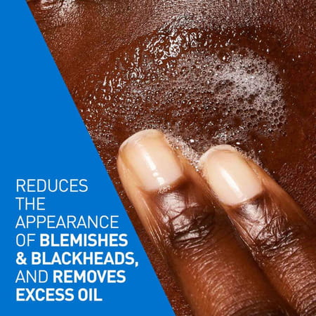 Cerave Blemish Control Cleanser With 2% Salicylic Acid & Niacinamide For Acne-Prone Skin 236ml