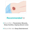 Maxiocel Wound Care Dressing For Bed Sores (2.5Cm X 30Cm) - Box Of 10 Units