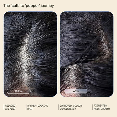 Arata Anti - Grey Hair Serum | Helps Slow Premature Greying | 30 Ml