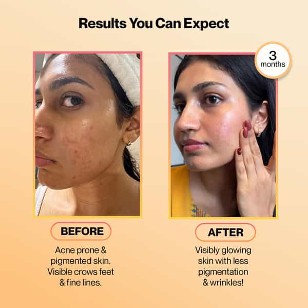 glutathione tablets before and after Buy SETU RADIANT SKIN COMBO What is Bac Water? skin serum BPC157:20mg