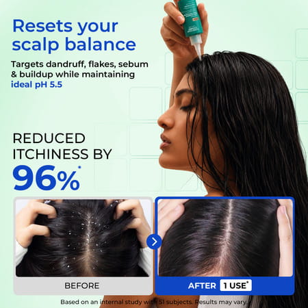 Conscious Chemist Anti-Dandruff Scalp Exfoliator | Pre-Wash Treatment | 50Ml