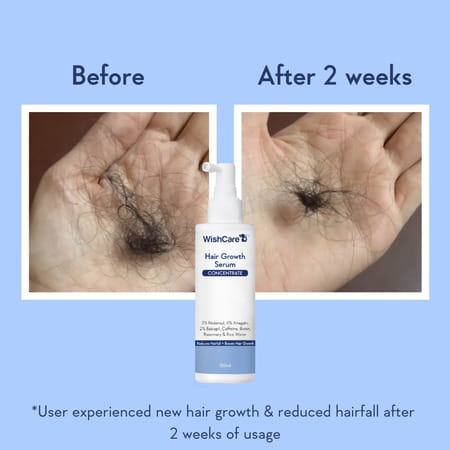Wishcare Hair Growth Serum Concentrate - Redensyl|Anagain|Caffeine|Biotin|Keratin|Rice Water 100Ml