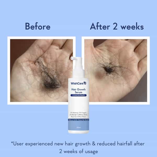 Wishcare Hair Growth Serum Concentrate - Redensyl|Anagain|Caffeine|Biotin|Keratin|Rice Water 100Ml
