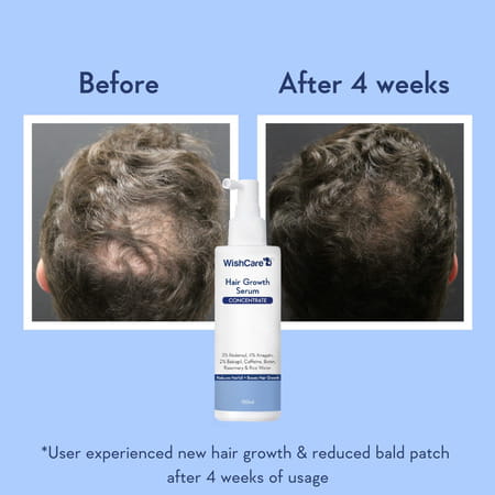 Wishcare Hair Growth Serum Concentrate - Redensyl|Anagain|Caffeine|Biotin|Keratin|Rice Water 100Ml