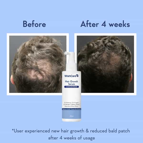 Wishcare Hair Growth Serum Concentrate - Redensyl|Anagain|Caffeine|Biotin|Keratin|Rice Water 100Ml