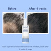 Wishcare Hair Growth Serum Concentrate - Redensyl|Anagain|Caffeine|Biotin|Keratin|Rice Water 100Ml