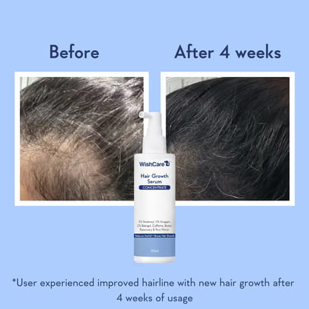 Wishcare Hair Growth Serum Concentrate - Redensyl|Anagain|Caffeine|Biotin|Keratin|Rice Water 100Ml