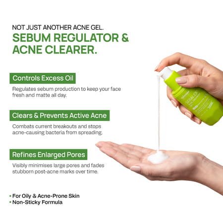 Yuderma Sebalex Acne Creamish Sebum Regulator Gel | 40 Ml