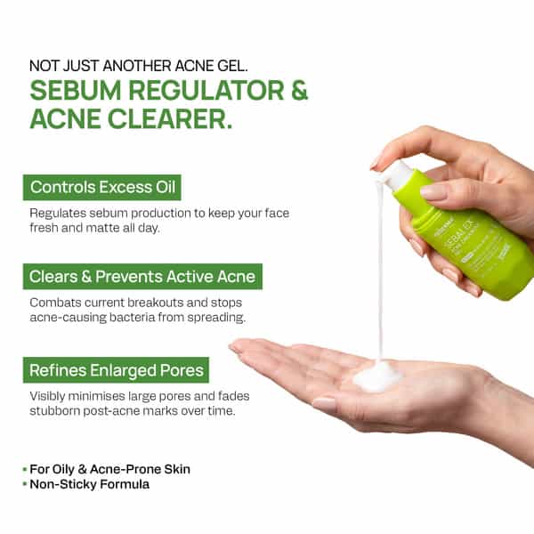 Yuderma Sebalex Acne Creamish Sebum Regulator Gel | 40 Ml
