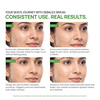 Yuderma Sebalex Acne Creamish Sebum Regulator Gel | 40 Ml
