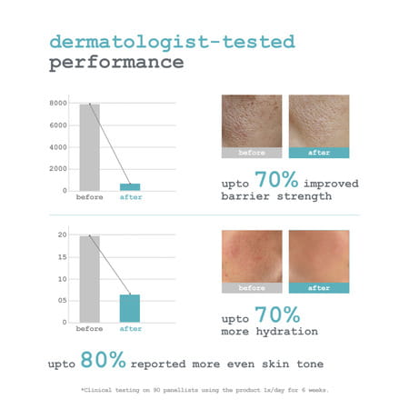 Dermacy Ceramide - 3 Barrier - Strengthening Micro Face Serum | 30Ml