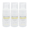 Acnedew Antiacne & Antipimple Foaming Face Wash 100 Ml | Salicylic Acid (Pack Of 3)
