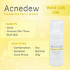 Acnedew Antiacne & Antipimple Foaming Face Wash 100 Ml | Salicylic Acid (Pack Of 3)