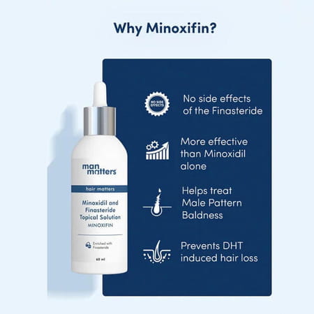 Man Matters Advance Growmax 5% With Finasteride Solution Serum I Prevent Hair Loss | Thinning | 60ml
